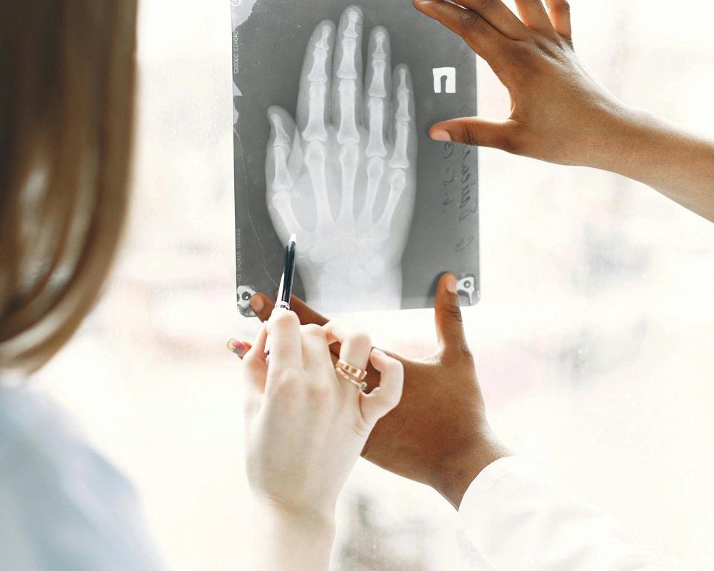 How to Reduce Melanin in Skin Naturally?